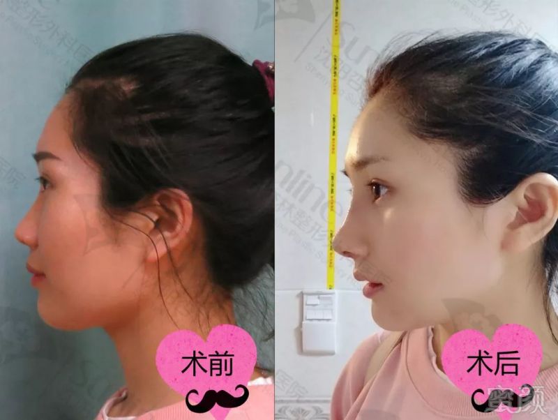 https://img.miyanlife.com/mnt/timg/190531/114AW245-11.jpg