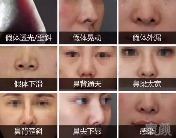 https://img.miyanlife.com/mnt/timg/190531/115Hab9-1.jpg