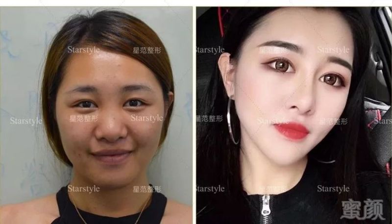 https://img.miyanlife.com/mnt/timg/190531/115I14212-8.jpg
