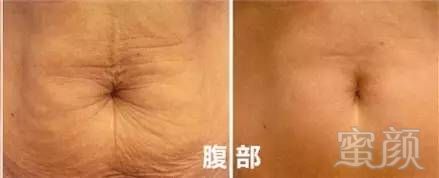https://img.miyanlife.com/mnt/timg/190531/115I96025-14.jpg
