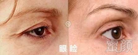 https://img.miyanlife.com/mnt/timg/190531/115IR1E-11.jpg