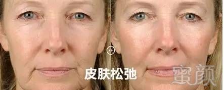 https://img.miyanlife.com/mnt/timg/190531/115IV021-12.jpg