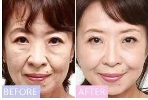 https://img.miyanlife.com/mnt/timg/190531/120445P00-1.jpg