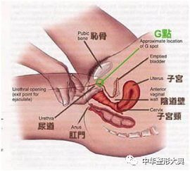 案例图片