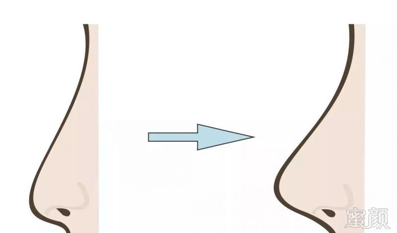 https://img.miyanlife.com/mnt/timg/190601/11594QA8-0.jpg