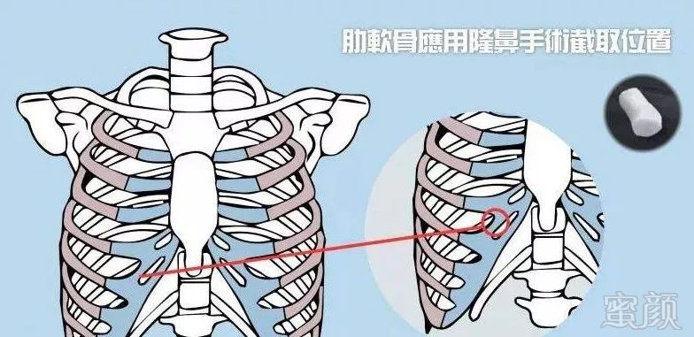 https://img.miyanlife.com/mnt/timg/190601/1159591314-4.jpg
