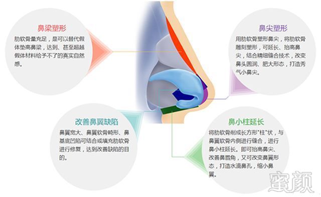 https://img.miyanlife.com/mnt/timg/190601/11595R245-3.jpg