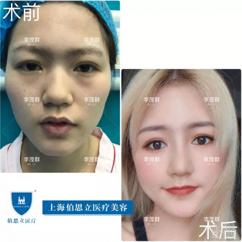 https://img.miyanlife.com/mnt/timg/190601/1200011142-7.jpg