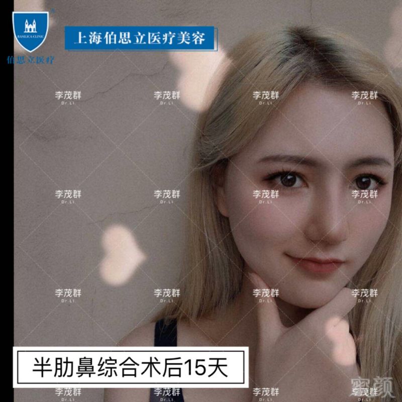 https://img.miyanlife.com/mnt/timg/190601/1200022R4-8.jpg