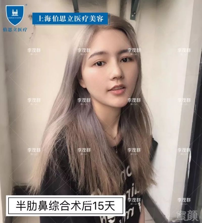 https://img.miyanlife.com/mnt/timg/190601/120003GP-9.jpg