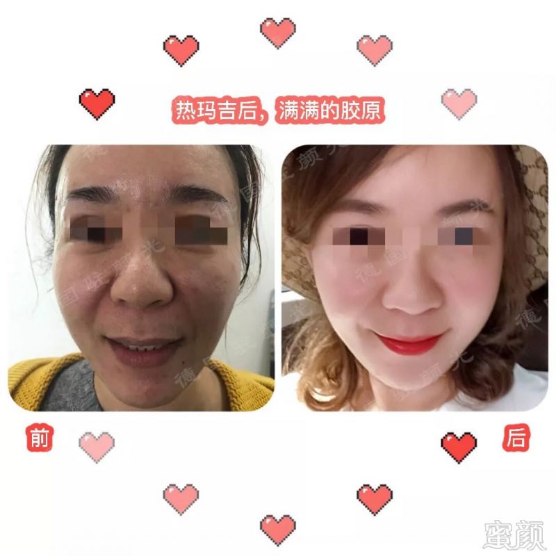 https://img.miyanlife.com/mnt/timg/190601/125KG3L-8.jpg