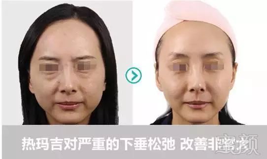 https://img.miyanlife.com/mnt/timg/190601/125P44508-12.jpg