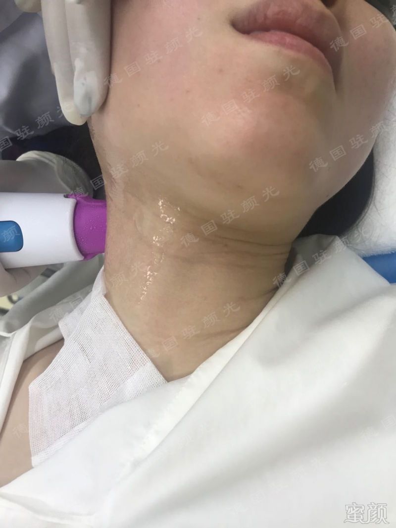 https://img.miyanlife.com/mnt/timg/190601/125P52250-14.jpg