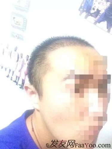 案例图片