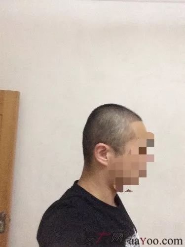 案例图片