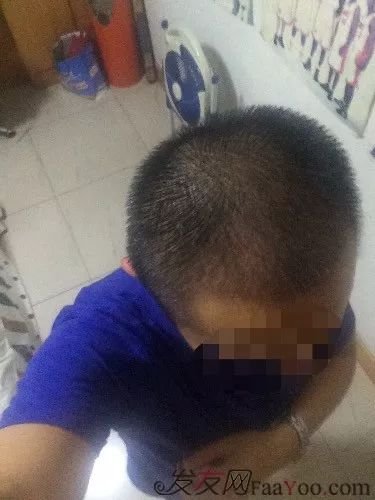 案例图片