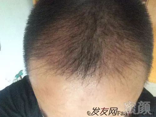 案例图片