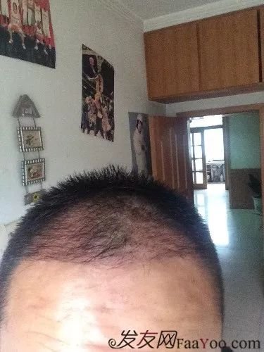 案例图片
