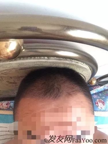 案例图片