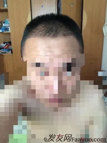 案例图片
