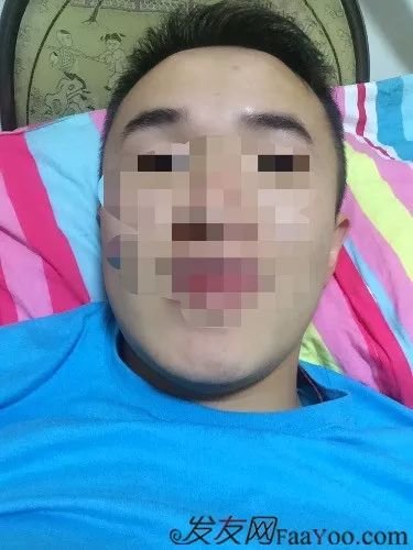 案例图片