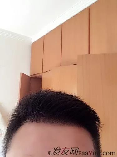 案例图片