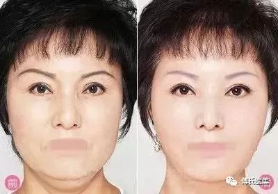 https://img.miyanlife.com/mnt/timg/190601/133PR918-10.jpg