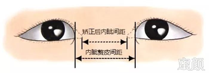 https://img.miyanlife.com/mnt/timg/190602/1136193961-10.jpg