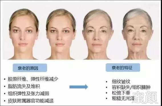 https://img.miyanlife.com/mnt/timg/190604/1041431O8-5.jpg