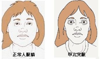 史上最最最最最全眼凸科普!不看错过全世界!