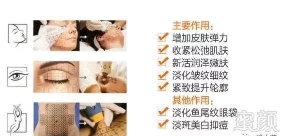 https://img.miyanlife.com/mnt/timg/190605/113042CT-1.jpg