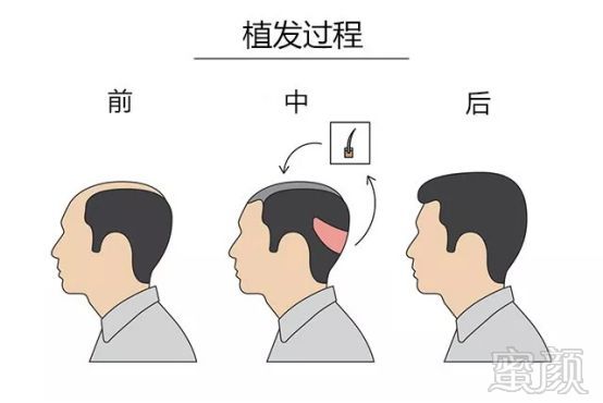 https://img.miyanlife.com/mnt/timg/190605/11505a144-1.jpg