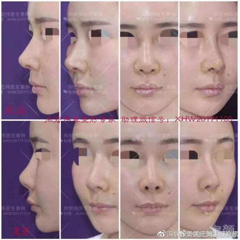 https://img.miyanlife.com/mnt/timg/190605/12042A541-6.jpg