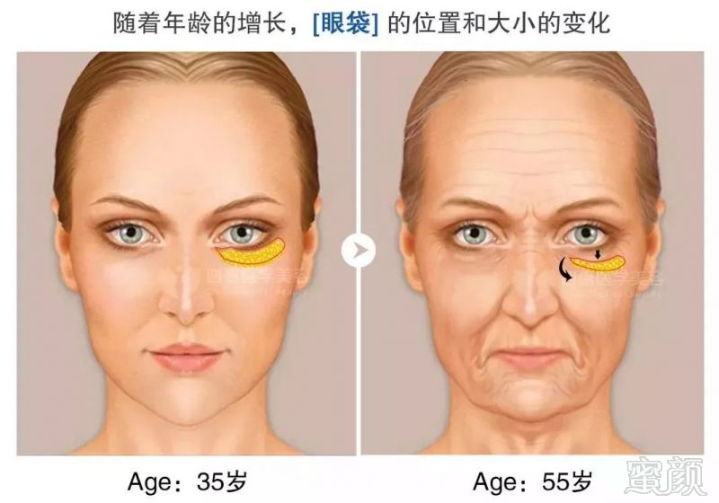 https://img.miyanlife.com/mnt/timg/190606/13150K937-18.jpg