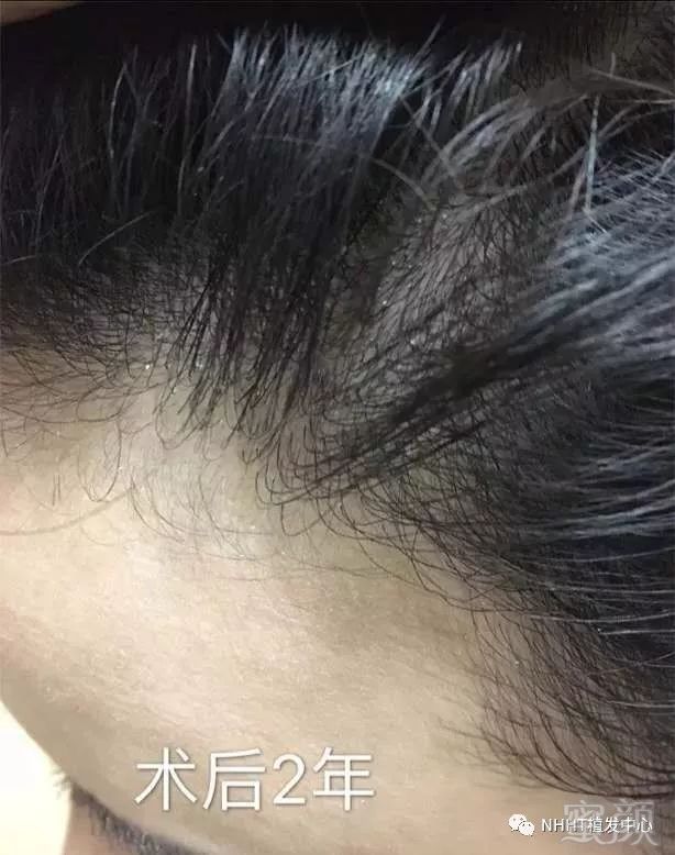 https://img.miyanlife.com/mnt/timg/190607/09454B262-11.jpg