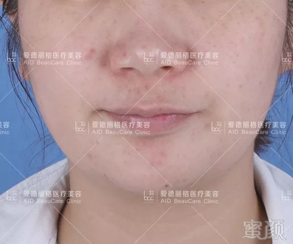 https://img.miyanlife.com/mnt/timg/190607/09541032N-1.jpg