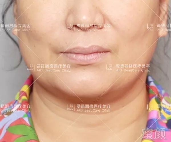 https://img.miyanlife.com/mnt/timg/190607/095410BO-0.jpg