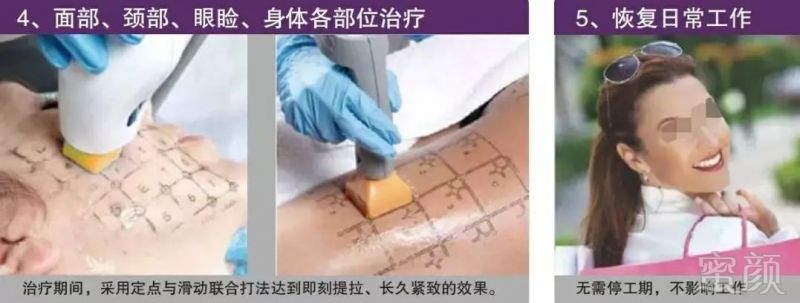 https://img.miyanlife.com/mnt/timg/190607/09541141Z-3.jpg