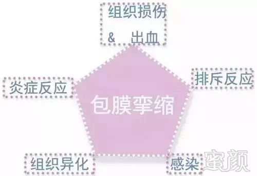 https://img.miyanlife.com/mnt/timg/190607/0U03KN4-10.jpg