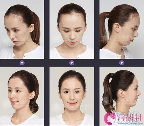 https://img.miyanlife.com/mnt/timg/190608/104050N07-2.jpg
