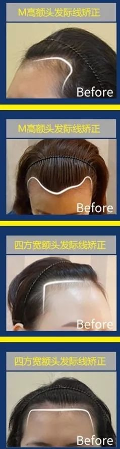 https://img.miyanlife.com/mnt/timg/190608/10405C409-4.jpg