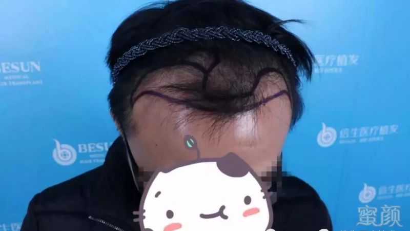 https://img.miyanlife.com/mnt/timg/190609/1044423K3-0.jpg