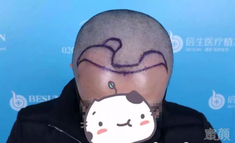 https://img.miyanlife.com/mnt/timg/190609/1044435403-1.jpg