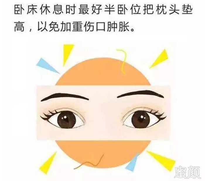 案例图片