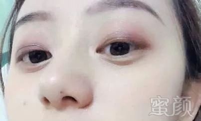 https://img.miyanlife.com/mnt/timg/190610/11200259E-4.jpg