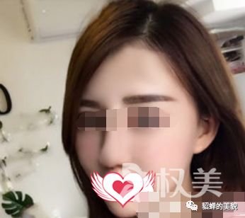 https://img.miyanlife.com/mnt/timg/190612/13320TM7-2.jpg