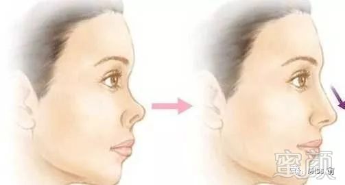 https://img.miyanlife.com/mnt/timg/190612/13354A051-13.jpg