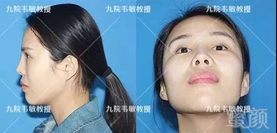 https://img.miyanlife.com/mnt/timg/190612/1339256225-1.jpg