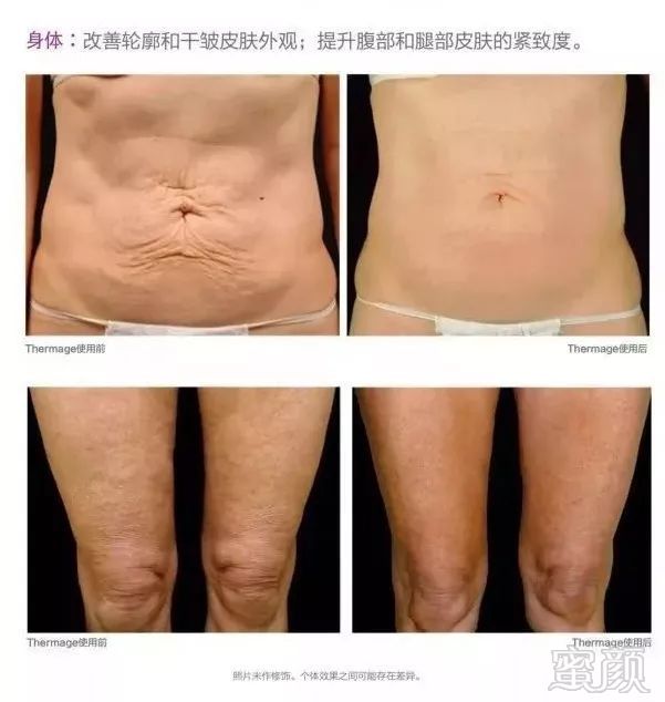 https://img.miyanlife.com/mnt/timg/190613/1202255352-8.jpg