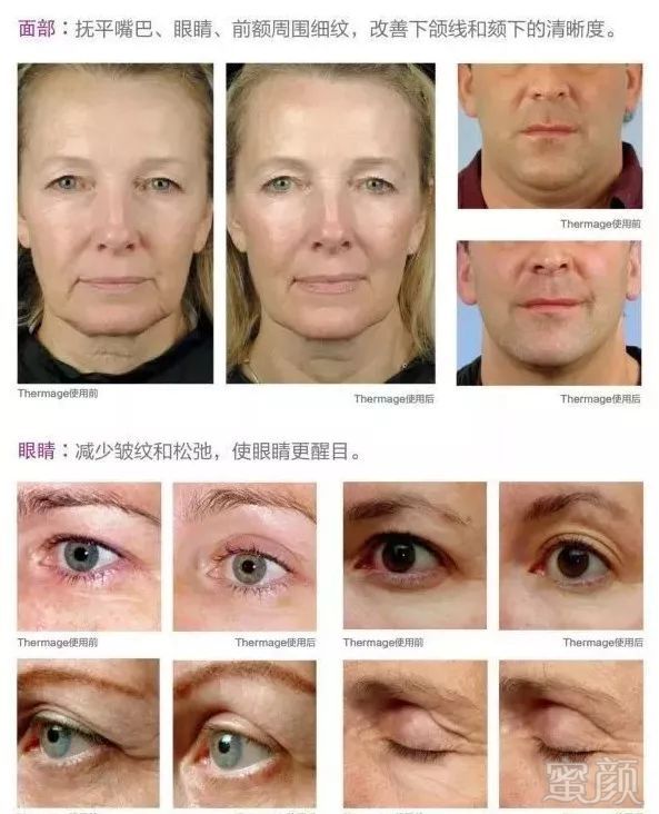 https://img.miyanlife.com/mnt/timg/190613/120225K34-7.jpg